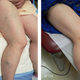 Illustration for article titled Searching for varicose vein laser treatment in Chicago? Call us!em/em